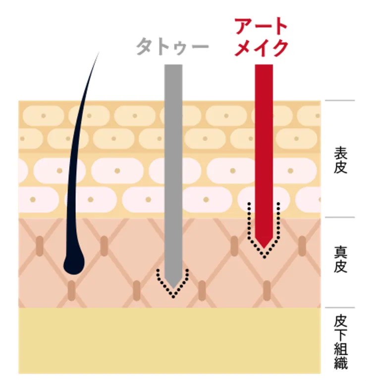 リップアートとは